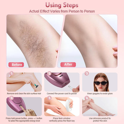 IPL Laser Hair Removal Device