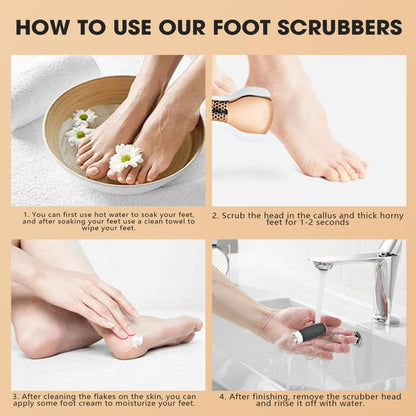 Dsp Electric Foot Callus Remover – 70426